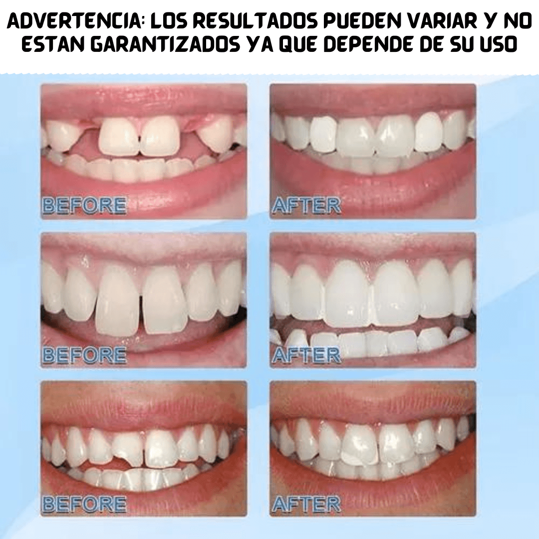 DENTFIX® | Repara, rellena y cubre huecos - Tienda Happy